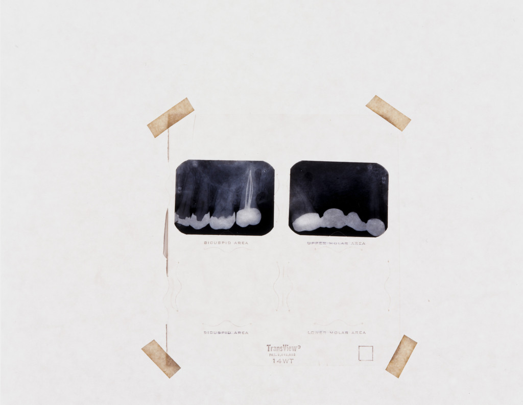 Dental X-Ray