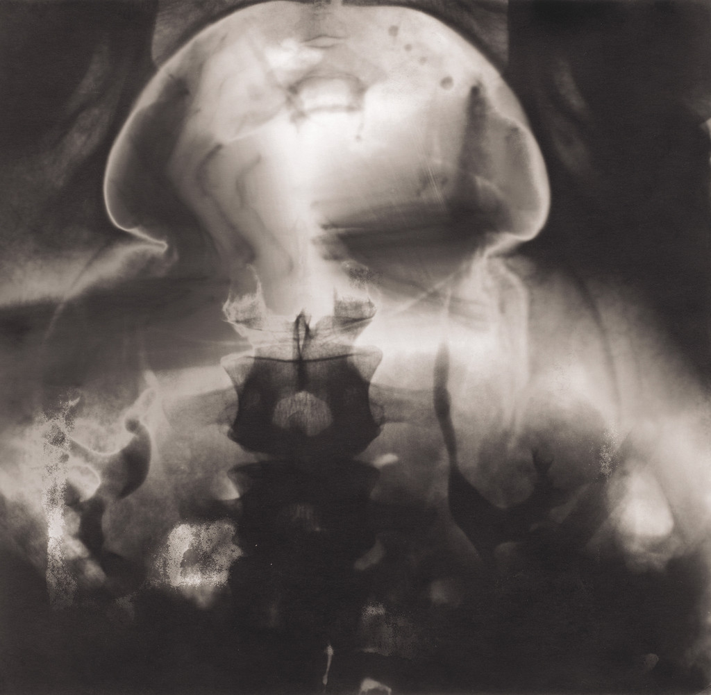 Mushroom Cloud