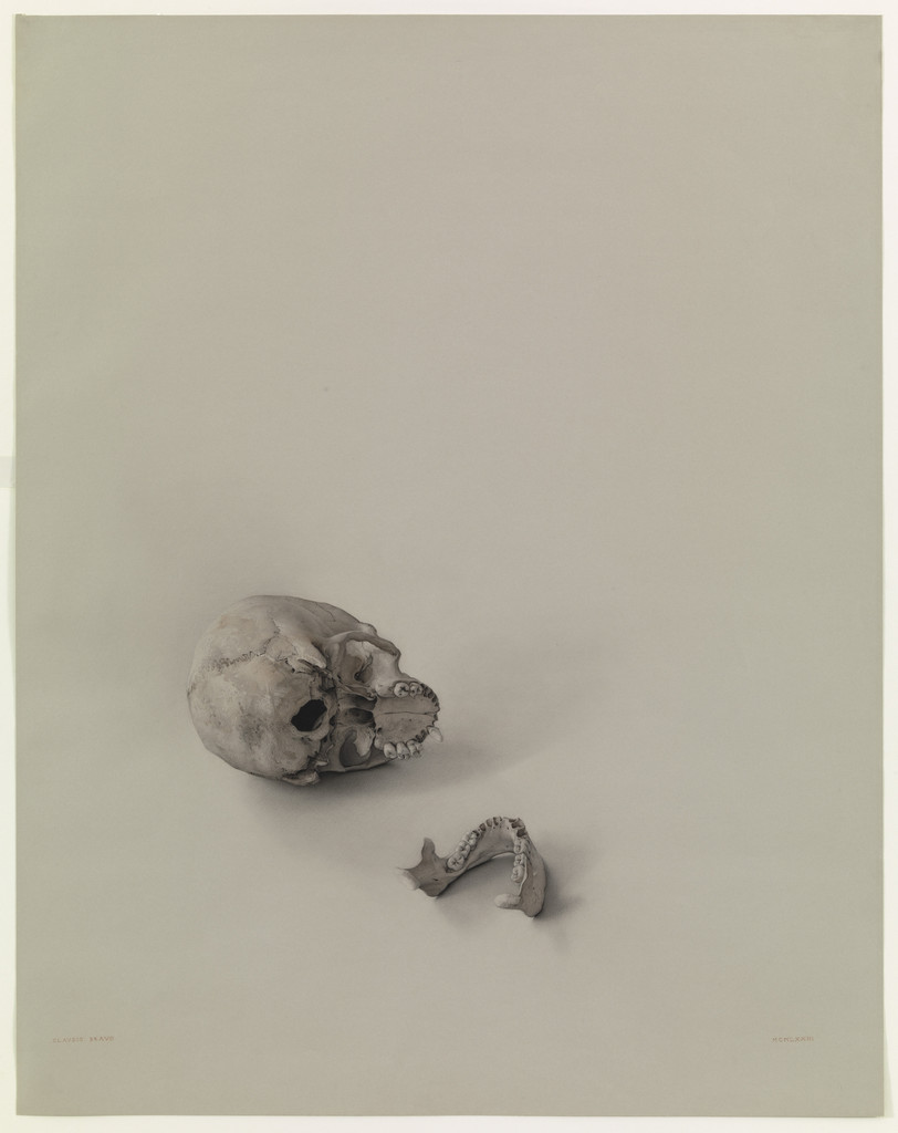 The Skull