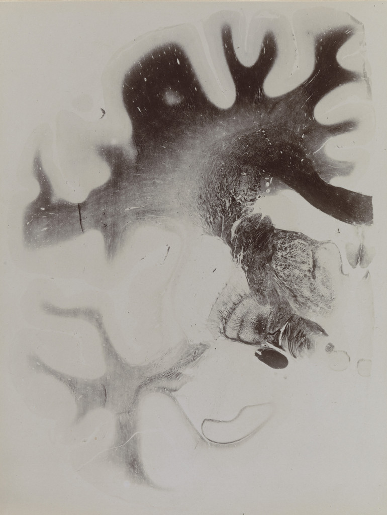 Map of the Brain: Cross-Section I, Frontal Section Plate 13 from an album published by The Psychiatric Clinic of Breslau