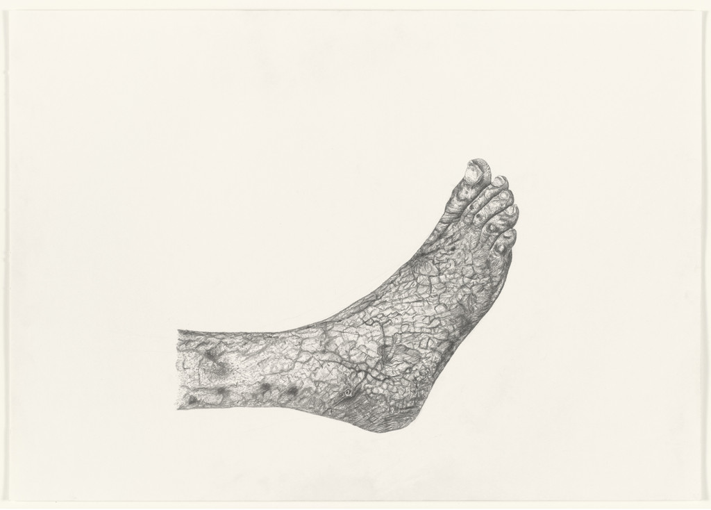 Claudication